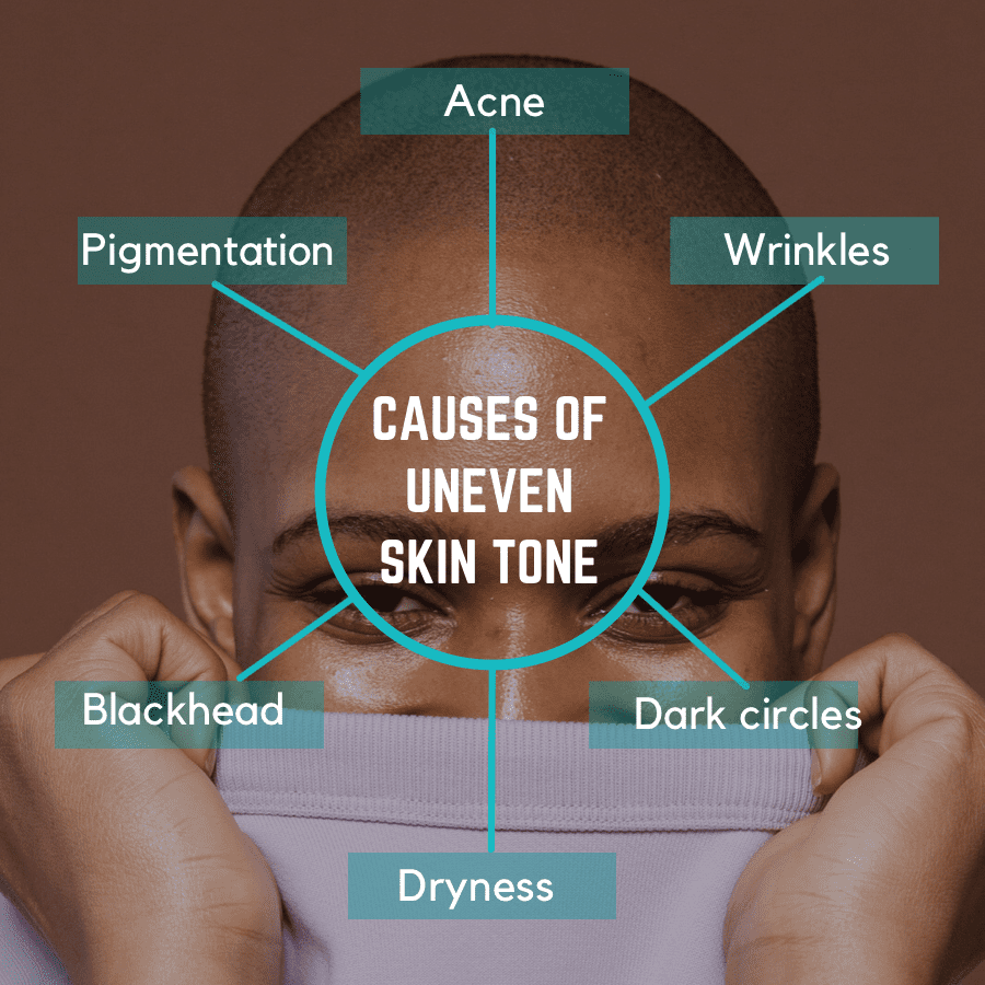 causes of uneven skin tone