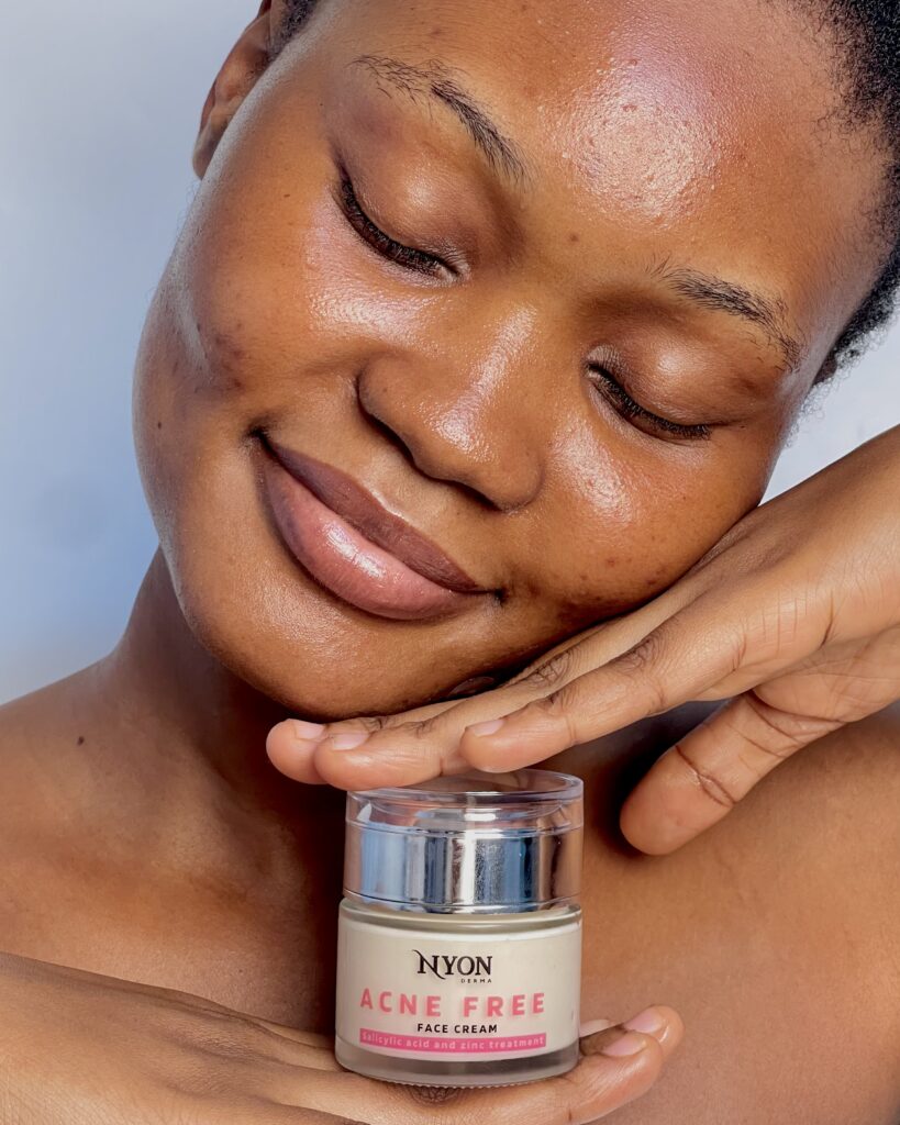Nyon Derma face cream for pimples and whitehead